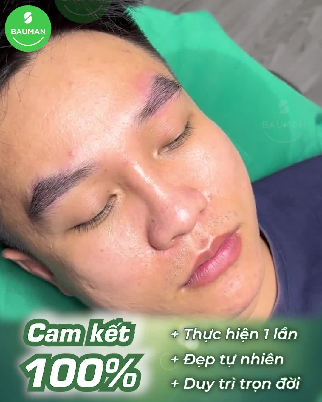 Bộ lông mày nam giới đẹp thu hút phái nữ ngay sau cấy