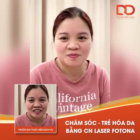 CHĂM SÓC - TRẺ HÓA DA BẰNG CÔNG NGHỆ LASER