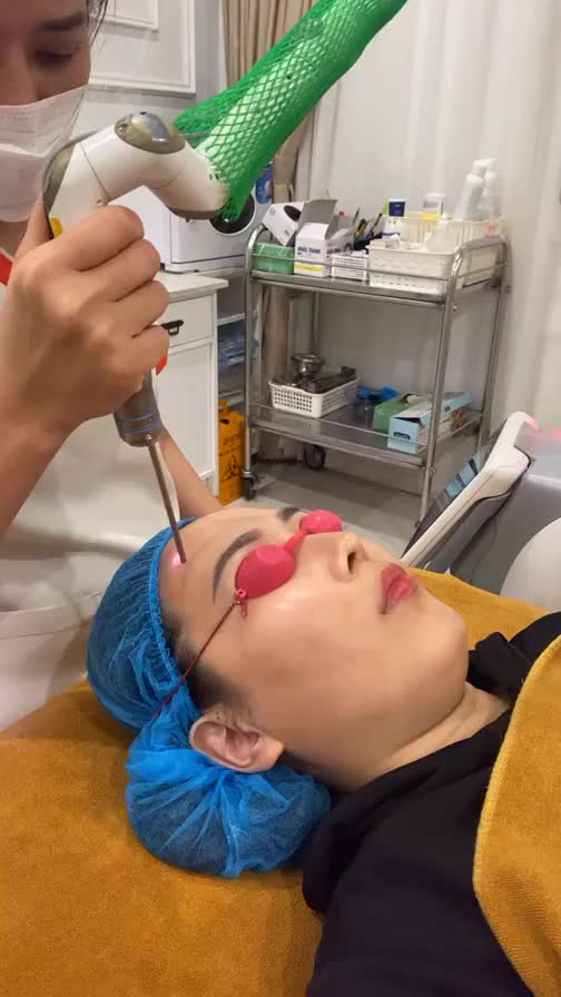 Khách hàng điều trị trẻ hoa da bằng CN Fotona StarWalker tại Thẩm mỹ DrD. Nay bạn thực hiện buổi thứ 3 trong liệu trình của mình.