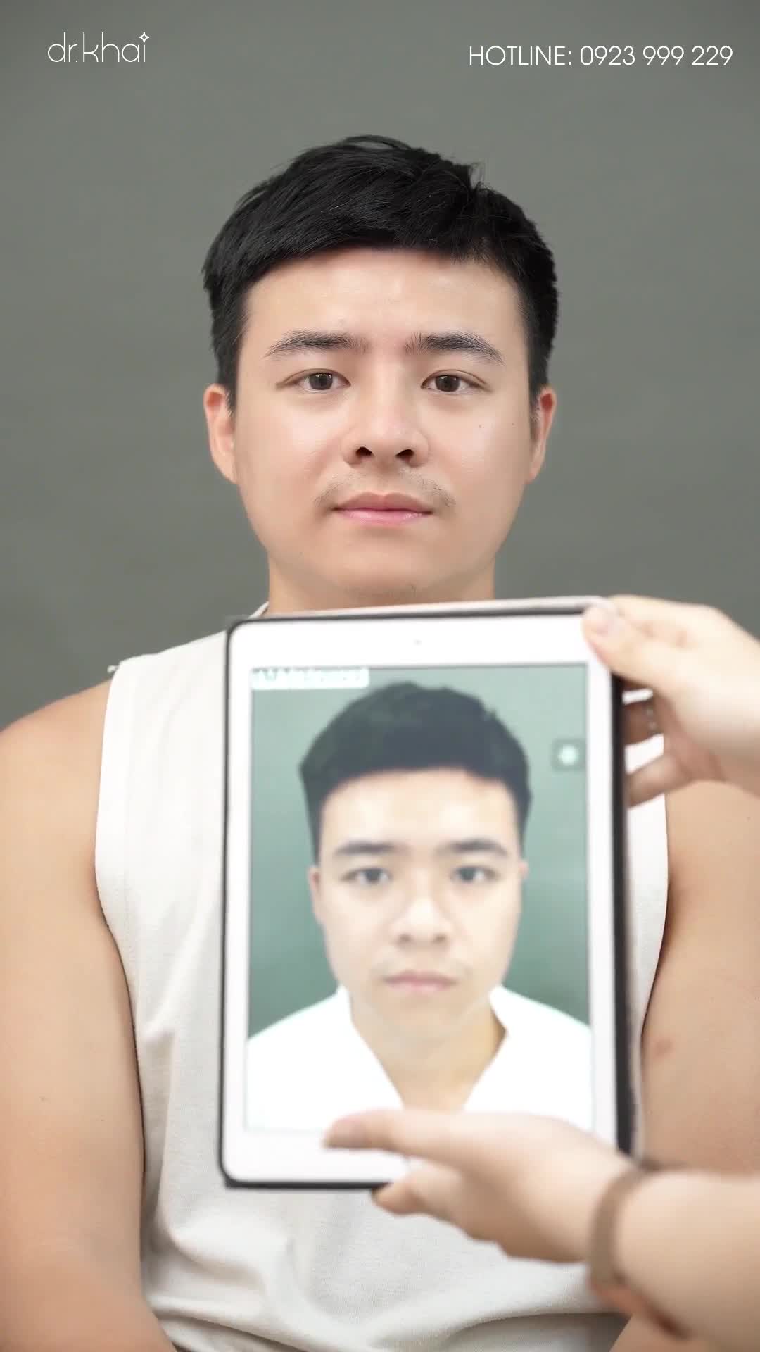 DÁNG MŨI ĐẸP CHO NAM GIỚI