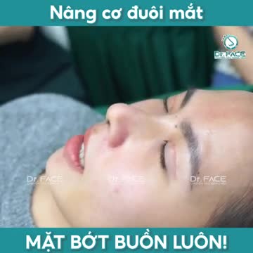 NÂNG CƠ ĐUÔI MẮT mặt bớt buồn luôn…