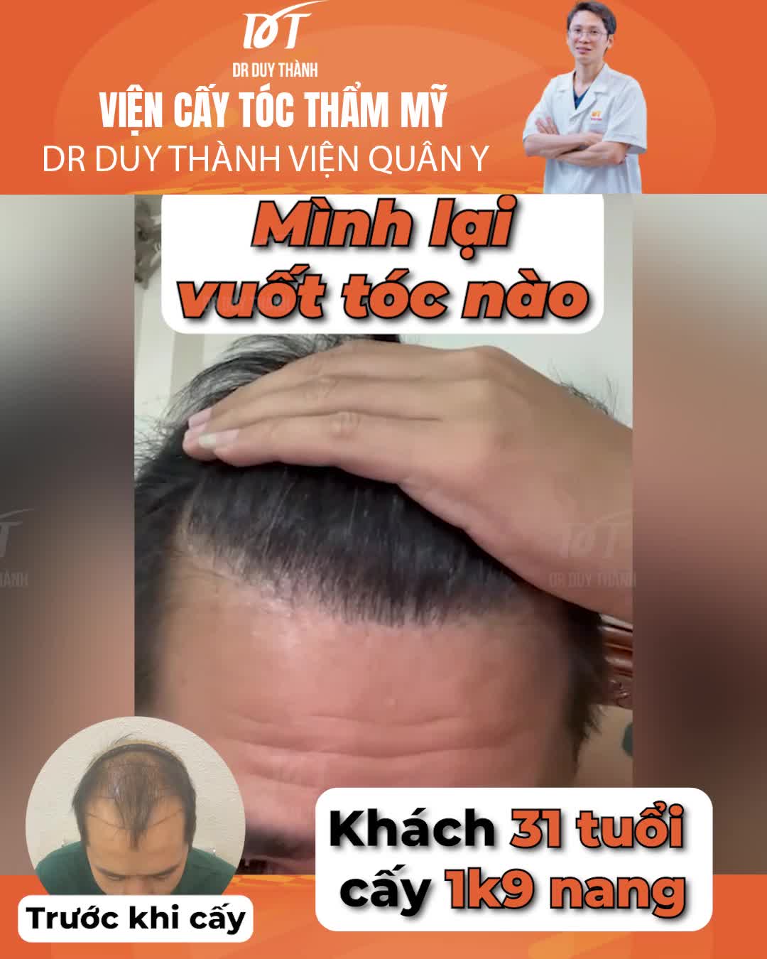 MÌNH LẠI VUỐT TÓC NÀO