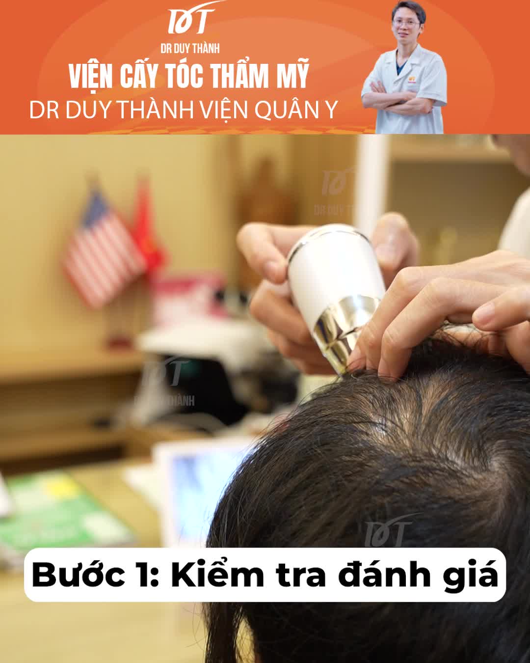 12 ngày sau cấy tóc, bong vảy trông sẽ như thế nào?