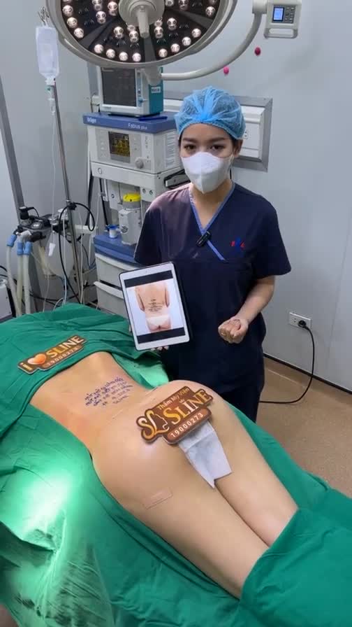 Thực hiện phương pháp : Hút mỡ 1/2 lưng dưới + Cấsy mỡ hõm mông.