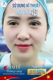HÈ LUNG LINH - TẬU MÍ XINH