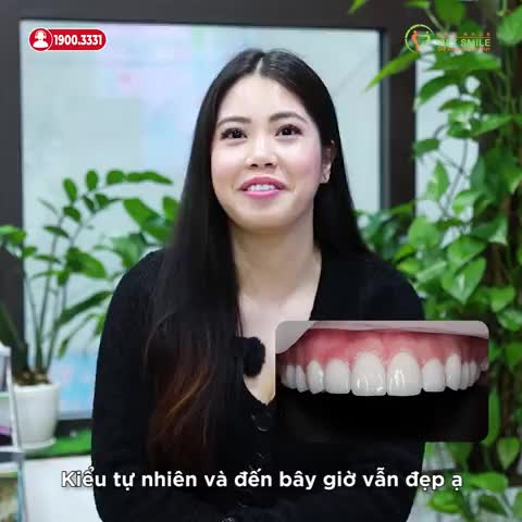 SAU 4 NĂM DÁN SỨ RĂNG VẪN TRẮNG ĐẸP TỰ NHIÊN?