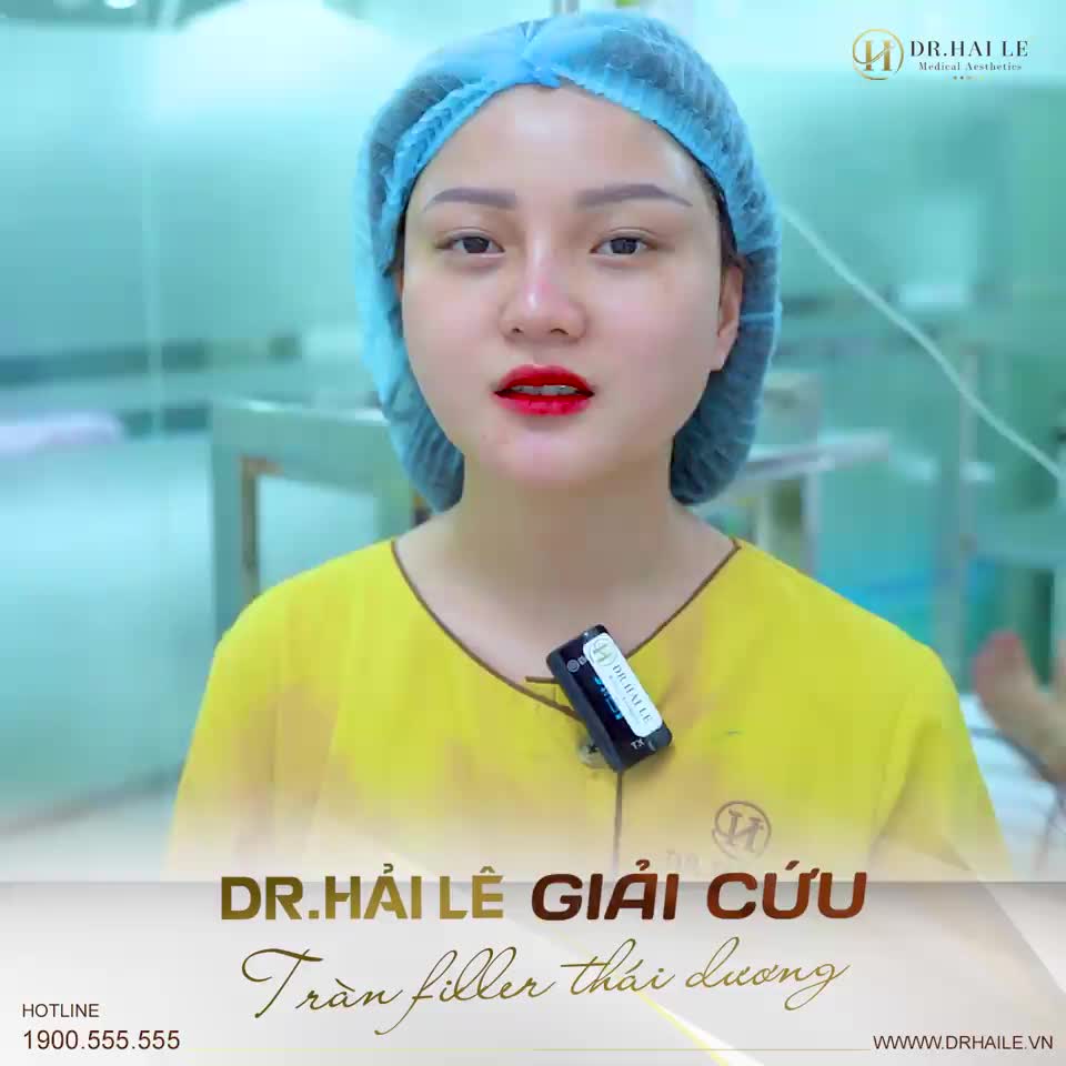 Từng tiêm Filler làm đầy vùng thái dương, vị khách hàng nhận thấy nhiều nhược điểm: Thời gian giữ form không lâu, tràn filler nguy hiểm, khó chịu