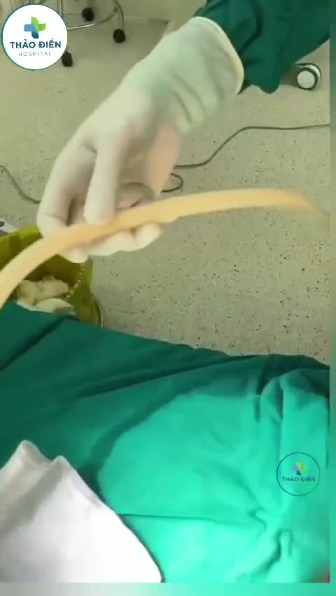 Công nghệ hút mỡ đa tầng Cavitron!!!