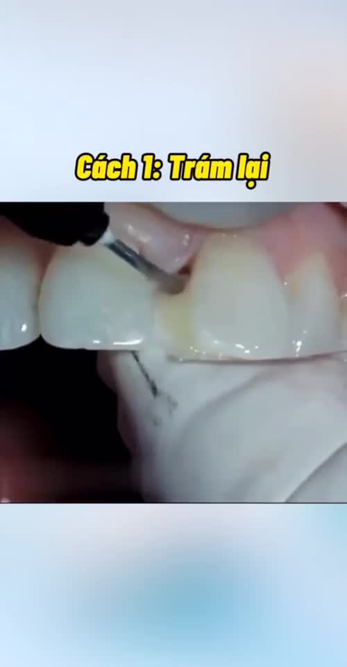 “ĐÓNG CỬA” RĂNG THƯA, ĐÓN “MƯA” TÀI LỘC