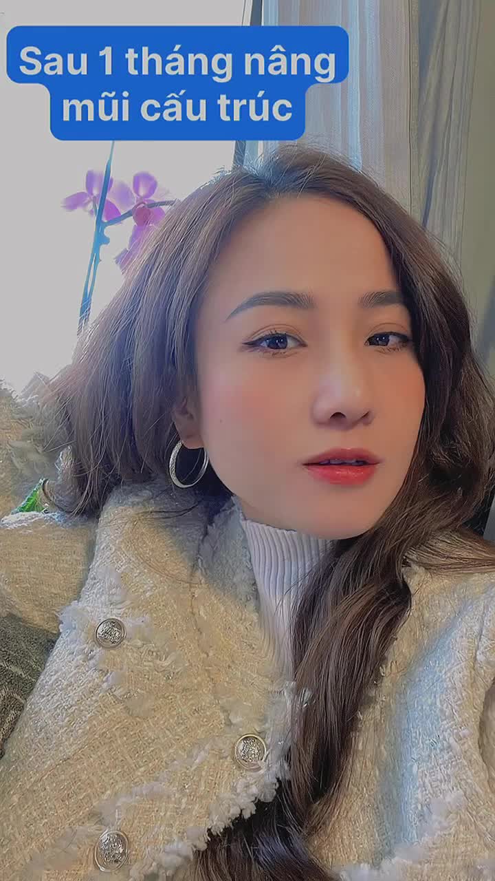 Nâng mũi cấu trúc rất xinh và tự nhiên ở đâu còn lâu chị mới nói là tại Bệnh Viện Quốc Tế Thảo Điền!
