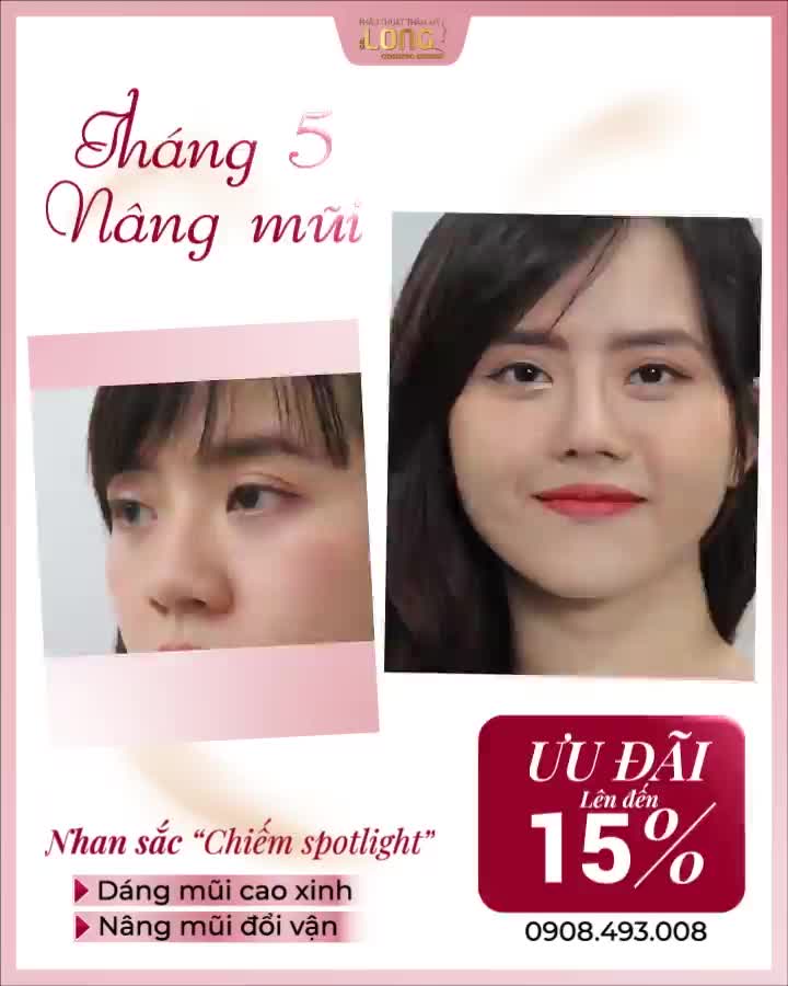 CHÀO THÁNG 5 RỰC RỠ - NÂNG MŨI SALE HẾT CỠ MŨI ĐẸP GIÁ TỐT  CHỐT NGAY TRONG THÁNG NÀY