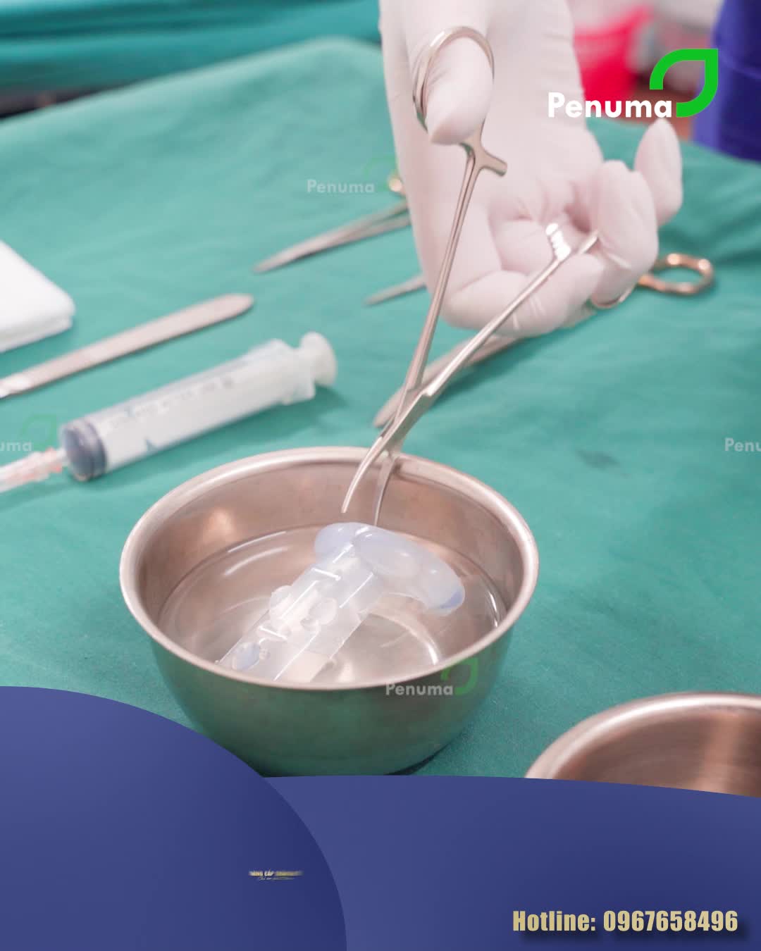 Phẫu thuật tăng kích thước cậu nhỏ bằng miếng độn silicon y tế