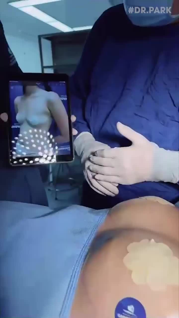 NÂNG NGỰC NỘI SOI LÀ GÌ? ƯU ĐIỂM NHƯ THẾ NÀO?