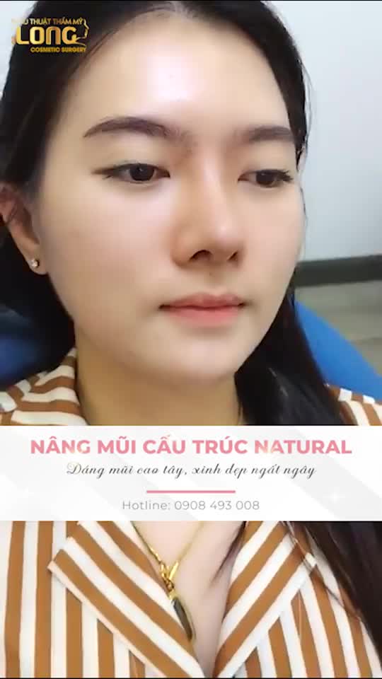 ĐẦU MÙA HÈ - ĐÃ CÓ DRAMA