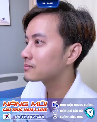 NÂNG MŨI L-LINE VÌ SAO PHÙ HỢP VỚI NAM GIỚI?