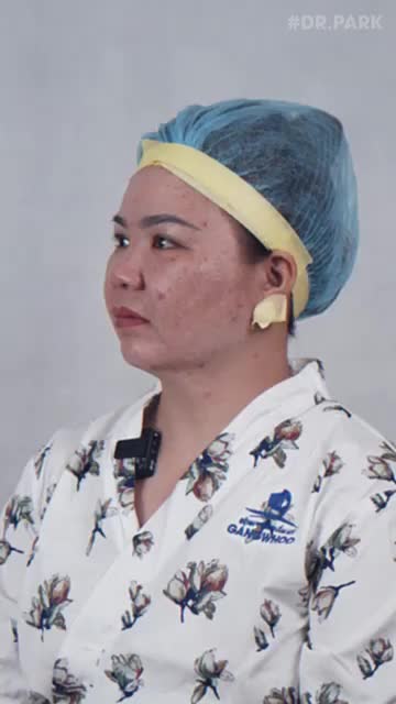 NÂNG MŨI CẤU TRÚC LÀ GÌ?