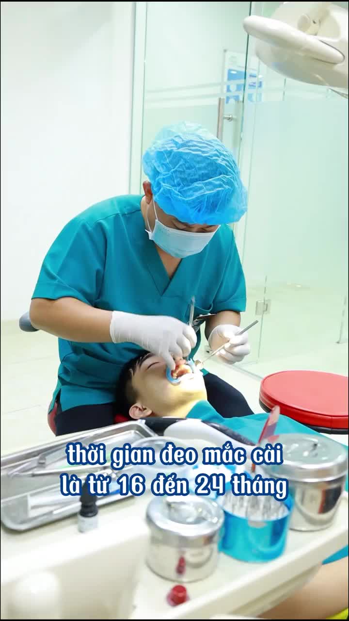 ĐEO HÀM DUY TRÌ BAO LÂU ĐỂ RĂNG KHÔNG BỊ CHẠY?