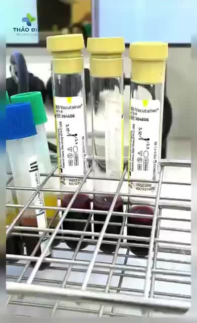 PRP CÔNG NGHỆ TRẺ HOÁ - TÁI SINH LÀN DA