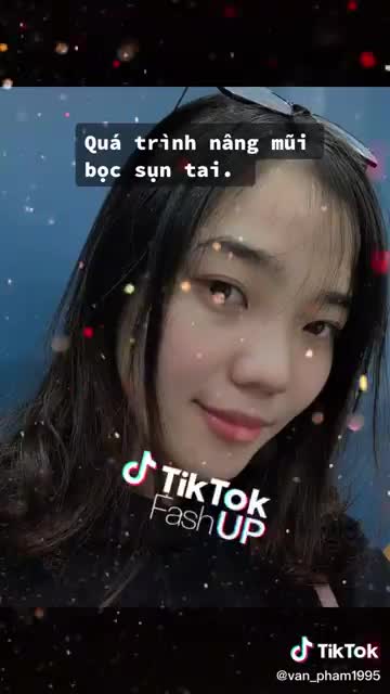Đôi khi việc chụp lại hình ảnh từng ngày sau phẫu thuật nâng mũi không chỉ để bạn nhìn lại quá trình thay đổi nhan sắc của mình mà thôi.