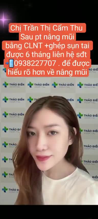 MŨI ĐẸP THỜI THƯỢNG -TƯỚNG MẠO CAO SANG