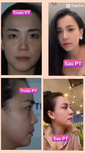 Đã là mặt trời lúc nào cũng tỏa nắng  Đã tìm Bs Thắng thì nhất định sẽ xinh