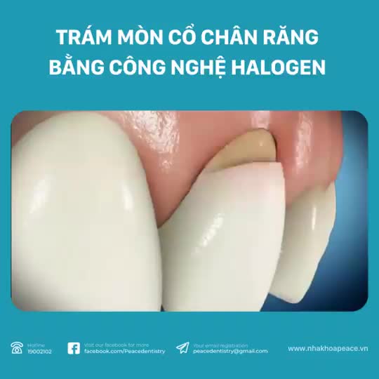 KẾT QUẢ MANG LẠI