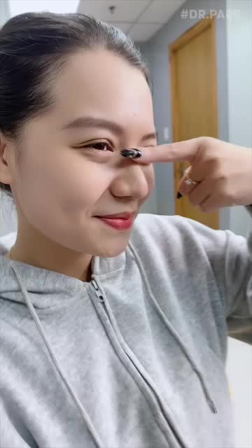 TẠI SAO NÂNG MŨI CẤU TRÚC NGÀY CÀNG HOT?