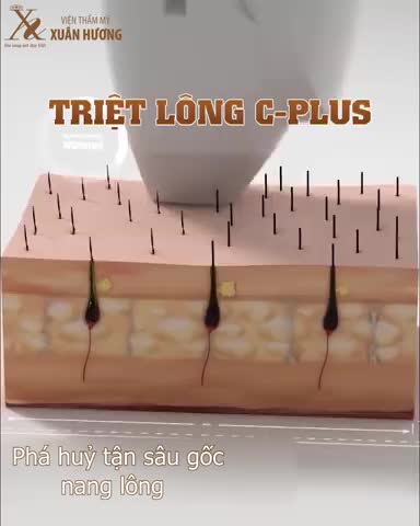 Hiệu quả ngay từ buổi đầu tiên - An toàn cho mọi vùng da cần triệt