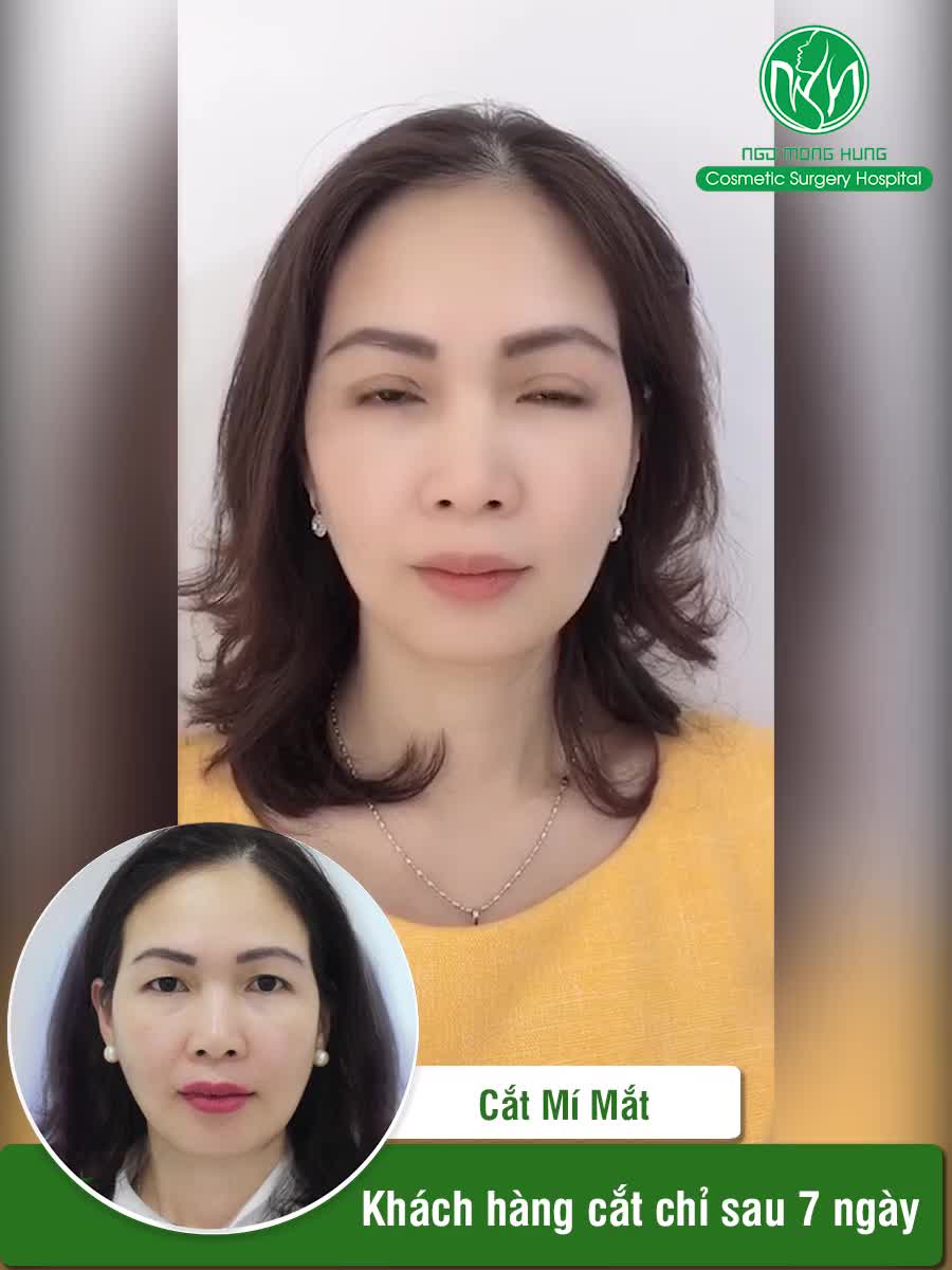 MẮT NHƯ NÀY LÀ ĐỦ ĐẸP CHƯA CÁC CHỊ EM