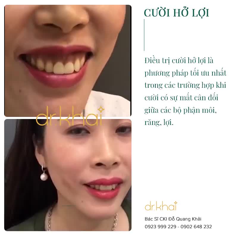 60 PHÚT CHỜ ĐỢI - VĨNH VIỄN TẠM BIỆT CƯỜI HỞ LỢI