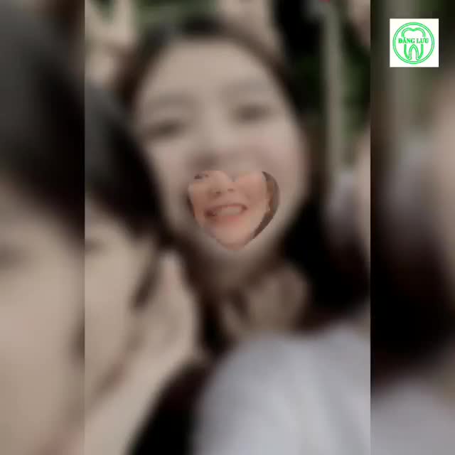 Yêu nhau có đôi. Niềng răng có hội