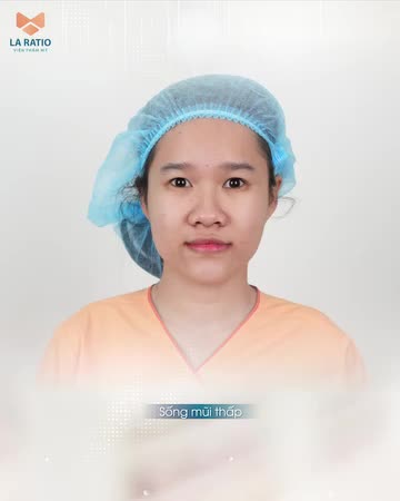 CÁNH MŨI TO BÈ - THU GỌN CHỈ VỚI 4,9 TRIỆU