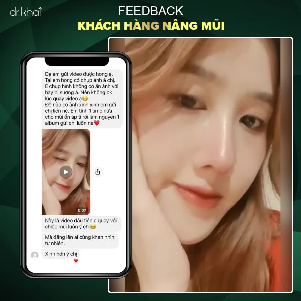 Feedback khách hàng nâng mũi được hơn 15 ngày.