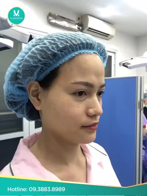 LÀM ĐẸP THÁNG TRỢ GIÁ - CẤY MỠ ĐẸP TỰ NHIÊN