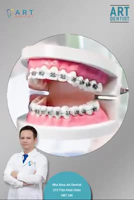 Dễ dàng niềng răng hơn với dịch vụ trả góp 0% tại Art Dentist