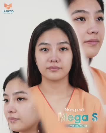MŨI ĐẸP CAO SANG - CÀNG NGẮM CÀNG MÊ