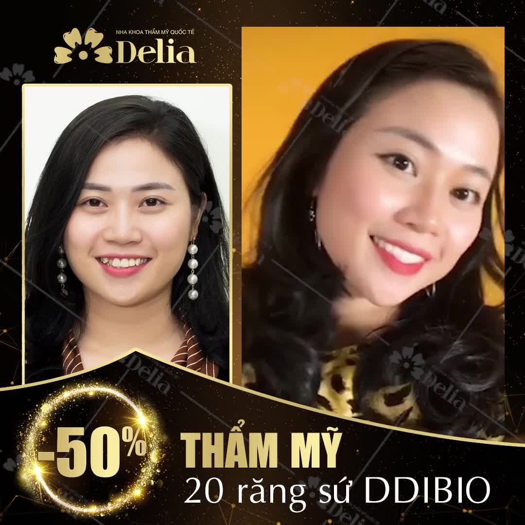 THẨM MỸ RĂNG SỨ NỤ CƯỜI RẠNG NGỜI TỰ TIN