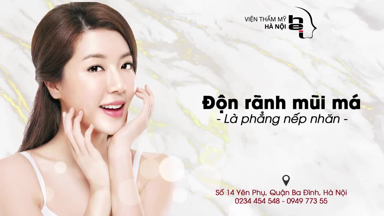 ĐỘN RÃNH MŨI MÁ - LÀ PHẲNG NẾP NHĂN
