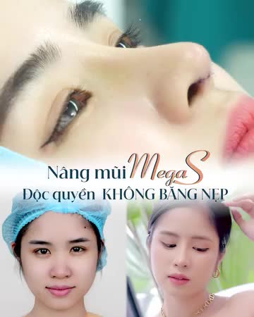 Nàng thơ Minh Trang xinh đẹp rạng rỡ với dáng mũi cao thanh tú