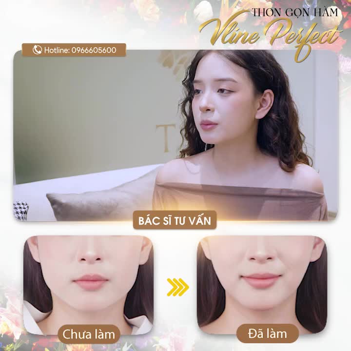 Khách hàng Phạm Trang đặt lịch đến Tấm tư vấn dịch vụ Vline Perfect. Sau khi kiểm tra bạn gặp tình trạng khuôn hàm vuông thô, bó cơ hai bên bạnh và nhiều mỡ.