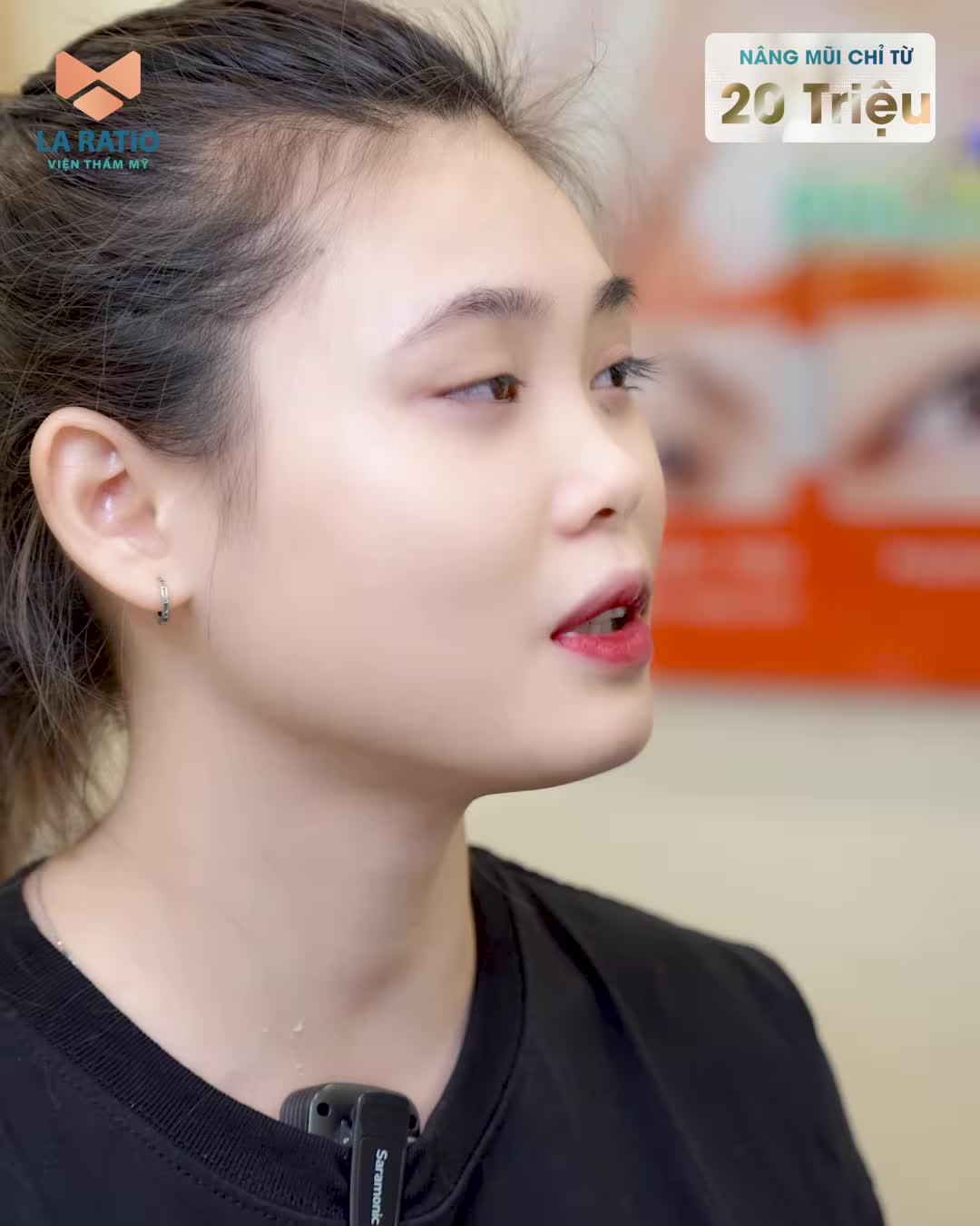 Mũi cao sang chảnh thần thái với Nâng mũi độc quyền không băng nẹp Ưu đãi "khủng" giảm trực tiếp 20Tr
