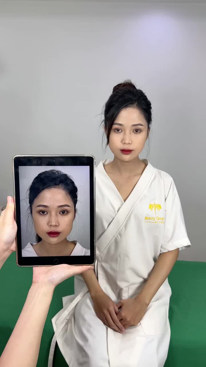 Ca Vline Perfect quay lại tái khám tại TMV Tấm