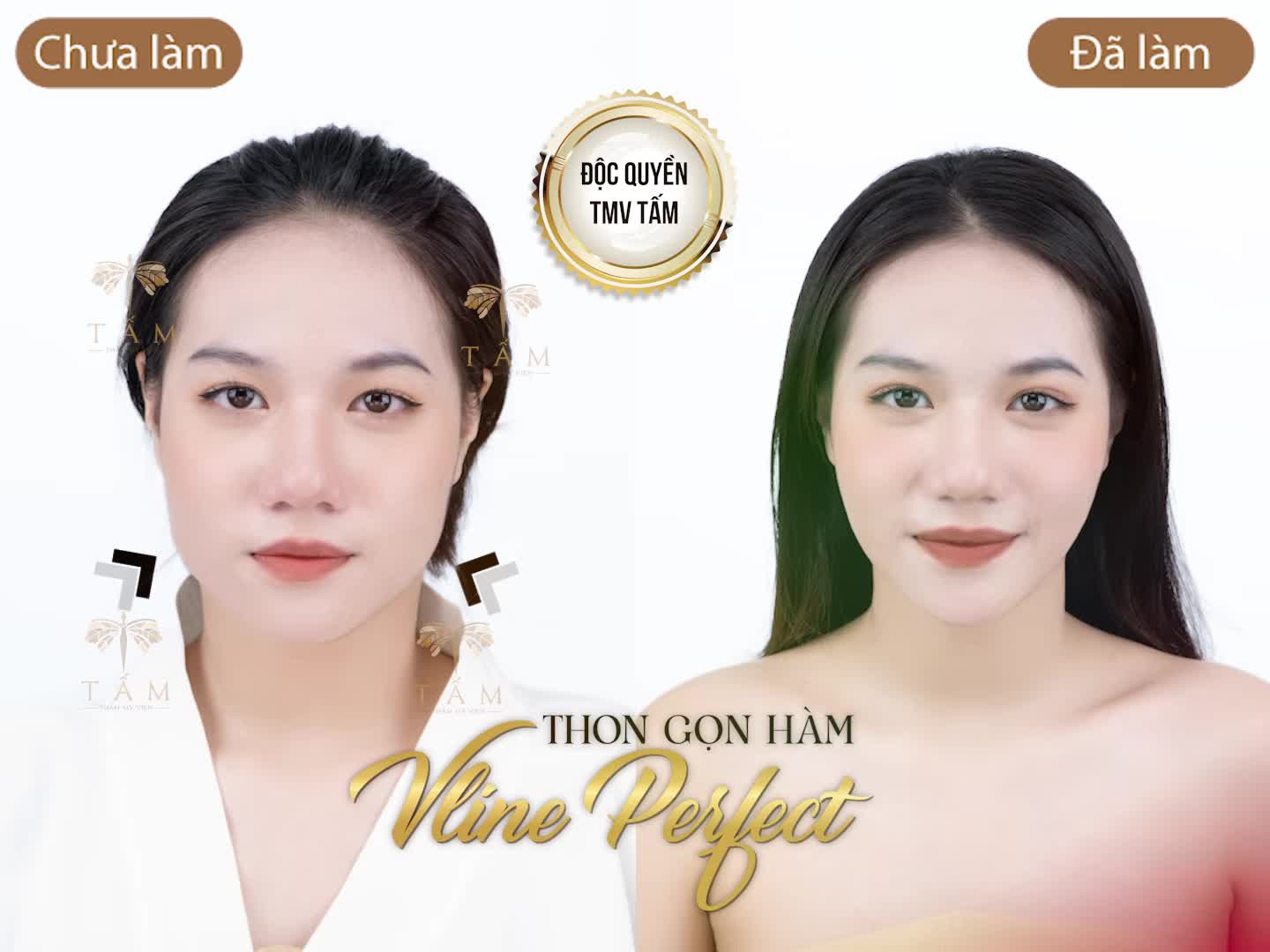 MẶT VUÔNG, HÀM BẠNH - XIN ĐỪNG NẢN LÒNG !!!