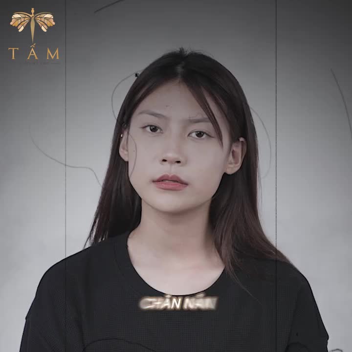 SỨC MẠNH CỦA THON GỌN HÀM VLINE PERFECT LÀ ĐÂY!