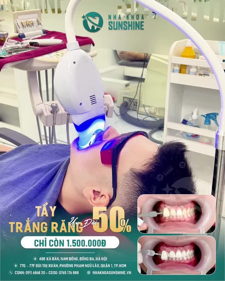 Hàm răng ố vàng, xỉn màu khiến bạn thiếu tự tin khi giao tiếp? Bạn đang tìm một địa chỉ Nha khoa uy tín để cải thiện cho nụ cười trở nên tự tin hơn?