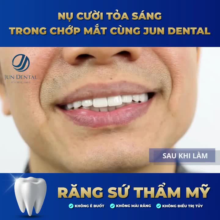 NỤ CƯỜI TỎA SÁNG TRONG CHỚP MẮT CÙNG JUN DENTAL