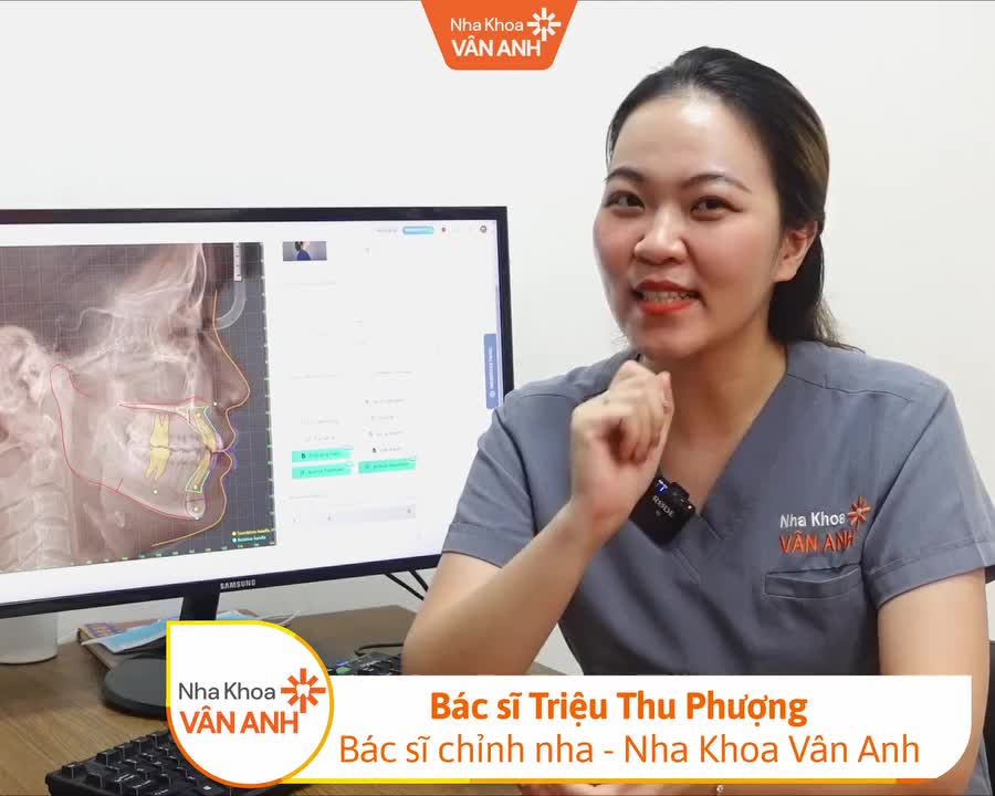 "BÍ KÍP" NIỀNG RĂNG ĐẸP SAU 2PHÚT