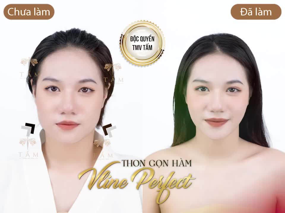 MẶT VUÔNG, HÀM BẠNH - XIN ĐỪNG NẢN LÒNG !!!