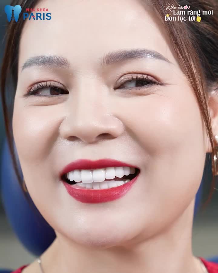 Từng trầm cảm vì hàm răng cũ, Việt kiều từ Mỹ về Việt Nam bọc sứ và cái kết vượt ngoài mong đợi!