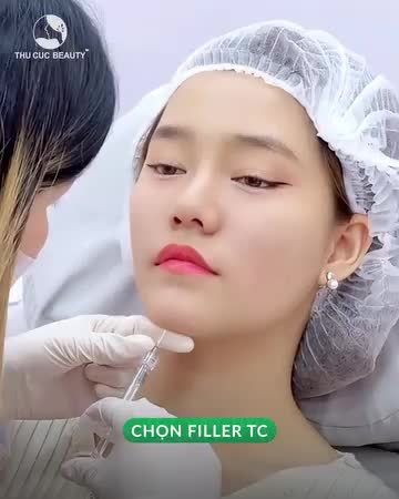 Khắc phục thái dương hõm, má hóp Chọn Filler TC
